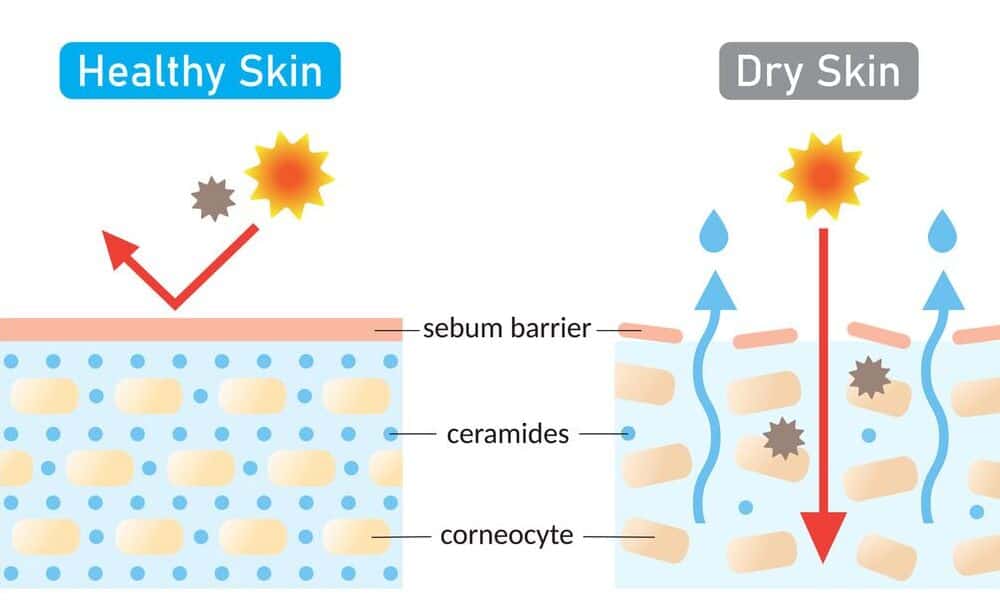 What Causes Transepidermal Water Loss alt What Causes Transepidermal Water Loss